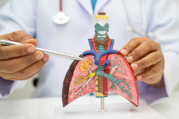Nuevas soluciones para diagnosticar y tratar enfermedades respiratorias en Guatemala