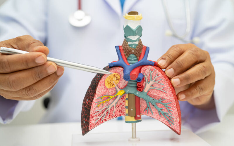 Nuevas soluciones para diagnosticar y tratar enfermedades respiratorias en Guatemala